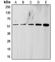 Polyclonal Rabbit anti-Human TGFBR1 / ALK5 Antibody (Internal, WB)