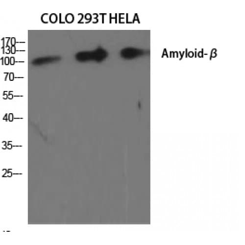 Beta Amyloid Antibody (680-760 aa)