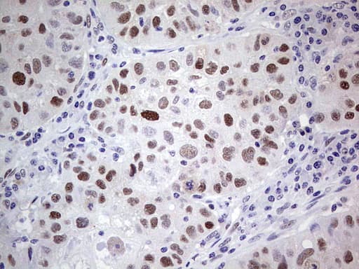 PCNA Antibody (clone OTI1A5)