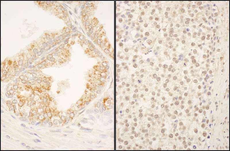 Polyclonal Rabbit anti-Human FBXO38 Antibody (aa825-875, IHC, WB)