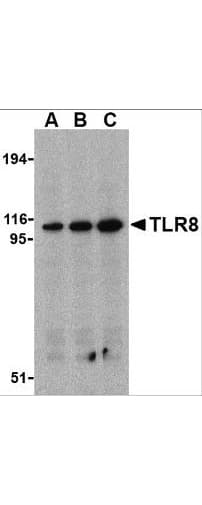 IHC-plus™ Polyclonal Rabbit anti-Human TLR8 Antibody (Internal, IHC, WB)