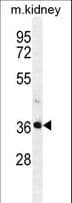 PIH1D2 Antibody (aa220-249)