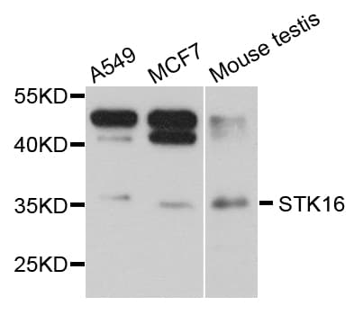 Polyclonal Rabbit anti-Human STK16 Antibody (WB)