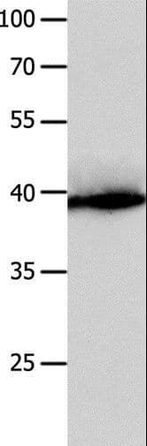 CFHR1 Antibody