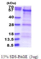 Human PKNOX1 / PREP1 Protein (Recombinant His)