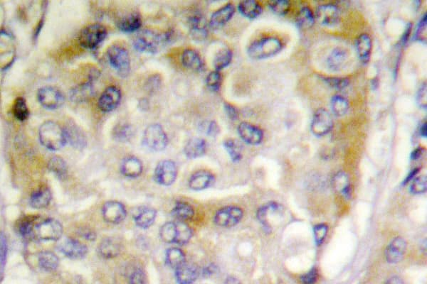 FAK / Focal Adhesion Kinase Antibody (Glu393)