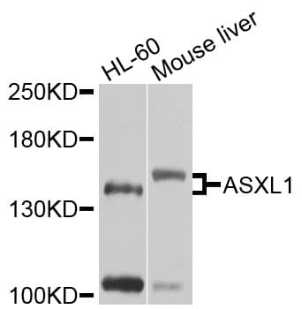 ASXL1 Antibody