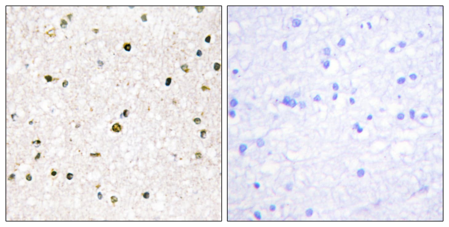 Polyclonal Rabbit anti-Human AKAP11 / KIAA0629 Antibody (aa1761-1810, IHC, IF)