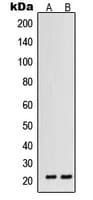 VEGFB Antibody (Internal)