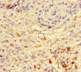 Polyclonal Rabbit anti-Human VGLL4 Antibody (aa43-277, IHC)