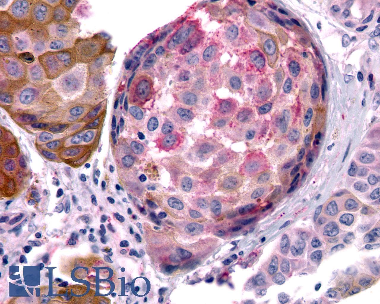 PathPlus™ Polyclonal Rabbit anti-Human MTNR1B / MT2 Antibody (Extracellular Domain, IHC)