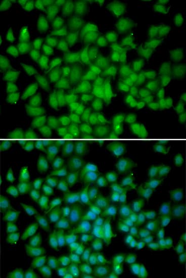 CDKN2C / p18 INK4c Antibody