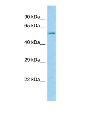 Polyclonal Rabbit anti-Mouse RORA / ROR Alpha Antibody (FITC, N-Terminus, WB)