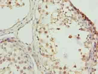 ZNF131 Antibody