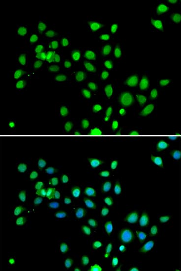 H2AFY / MACROH2A1 Antibody