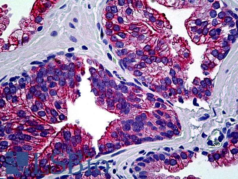 IHC-plus™ Polyclonal Rabbit anti-Human ARHGEF19 / WGEF Antibody (aa251-300, IHC)