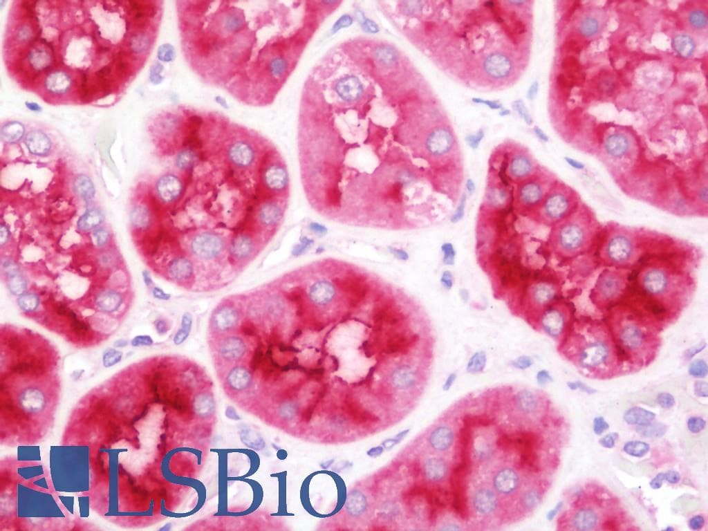 IHC-plus™ Polyclonal Rabbit anti-Human XPNPEP2 Antibody (aa286-564, IHC, WB)