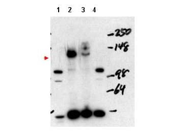 IHC-plus™ Polyclonal Rabbit anti-Human NCOA3 / SRC-3 / AIB1 Antibody (IHC, WB)