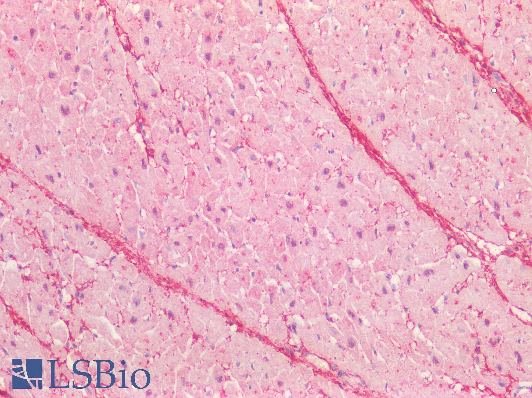 IHC-plus™ CTGF Antibody (Amino Acids 111-123)