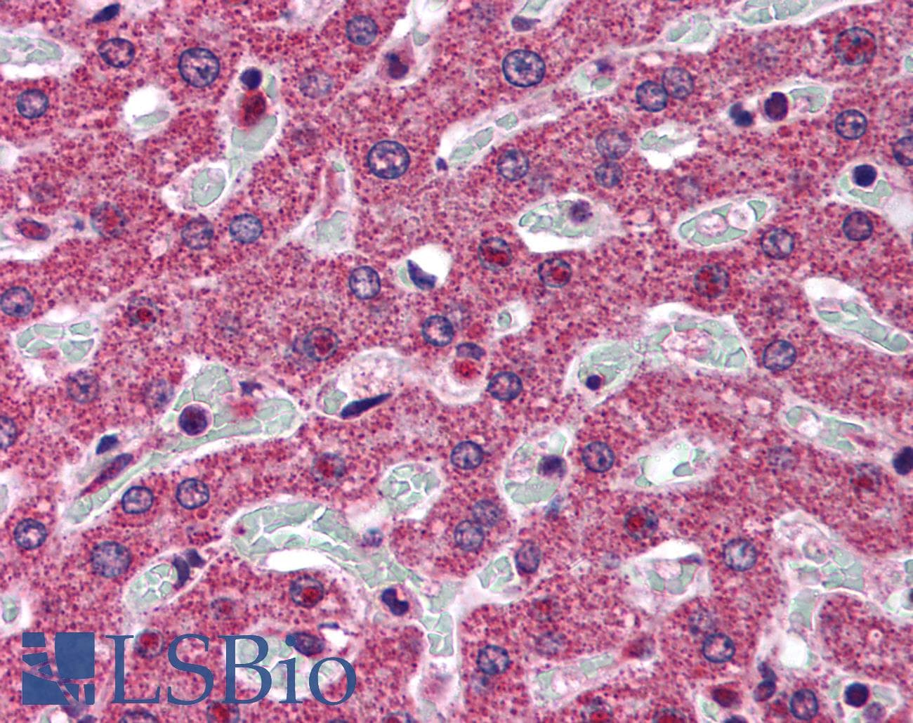IHC-plus™ 5-Alpha Reductase / SRD5A1 Antibody (aa2-13)
