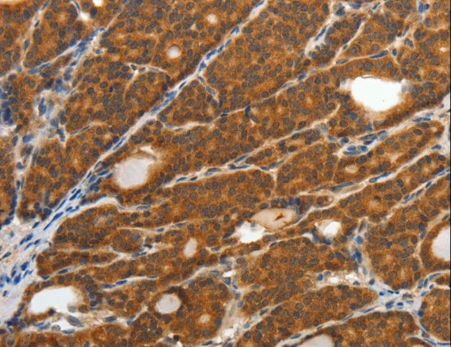 Polyclonal Rabbit anti-Human CRP / C-Reactive Protein Antibody (IHC, WB)