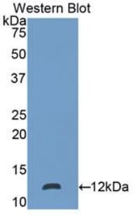 S100P Antibody (aa1-95, FITC)