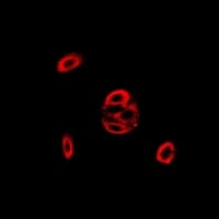 Polyclonal Rabbit anti-Human FIS1 Antibody (IF, WB)
