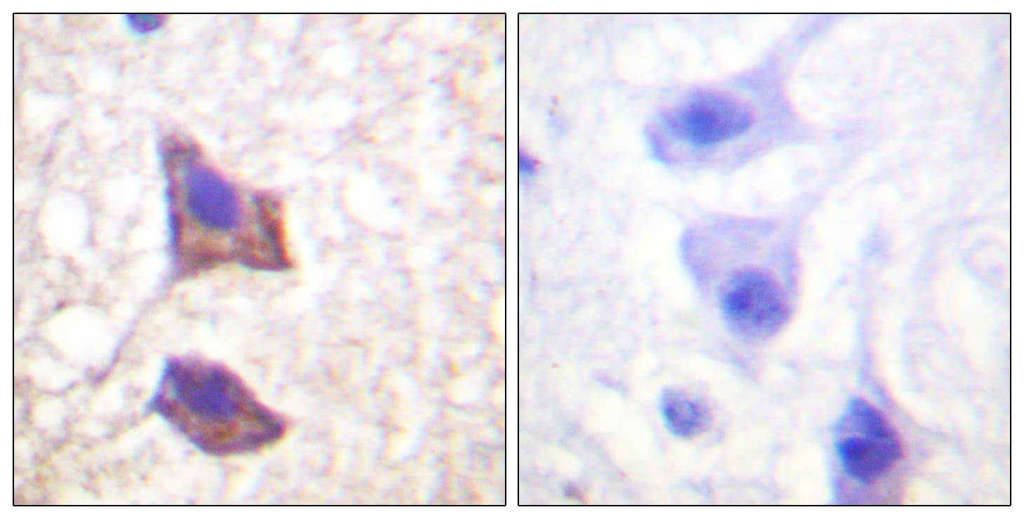 Polyclonal Rabbit anti-Human IL6ST / CD130 / gp130 Antibody (aa748-797, IHC, IF, WB)