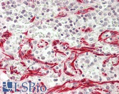 IHC-plus™ Polyclonal Rabbit anti-Human MLZE Antibody (aa109-158, IHC, WB)