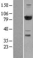 PFKP Protein (Over-Expression Lysate Myc-DDK (Flag))