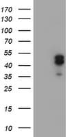 LHX1 Antibody (aa100-362, clone OTI2D5)