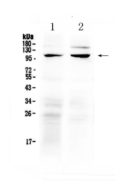 TRPC6 Antibody