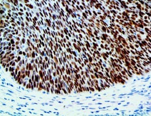 p14ARF / CDKN2A Antibody (clone RBT-p14, Ready-to-Use)