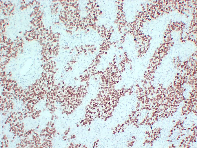 SALL4 Antibody (clone ABT-SALL4)