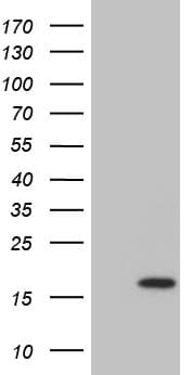 Monoclonal Mouse anti-Human DPPA5 Antibody (clone OTI2F6, WB)