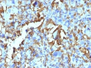 HLA-DRB1 Antibody (clone LN3 + HLA-DRB/1067, Azide-free, BSA-free)