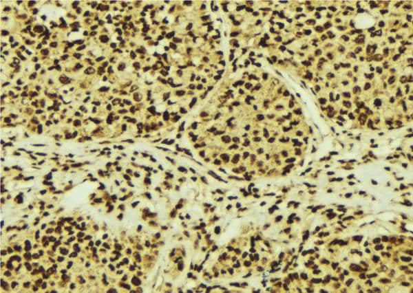 RPS3 / Ribosomal Protein S3 Antibody