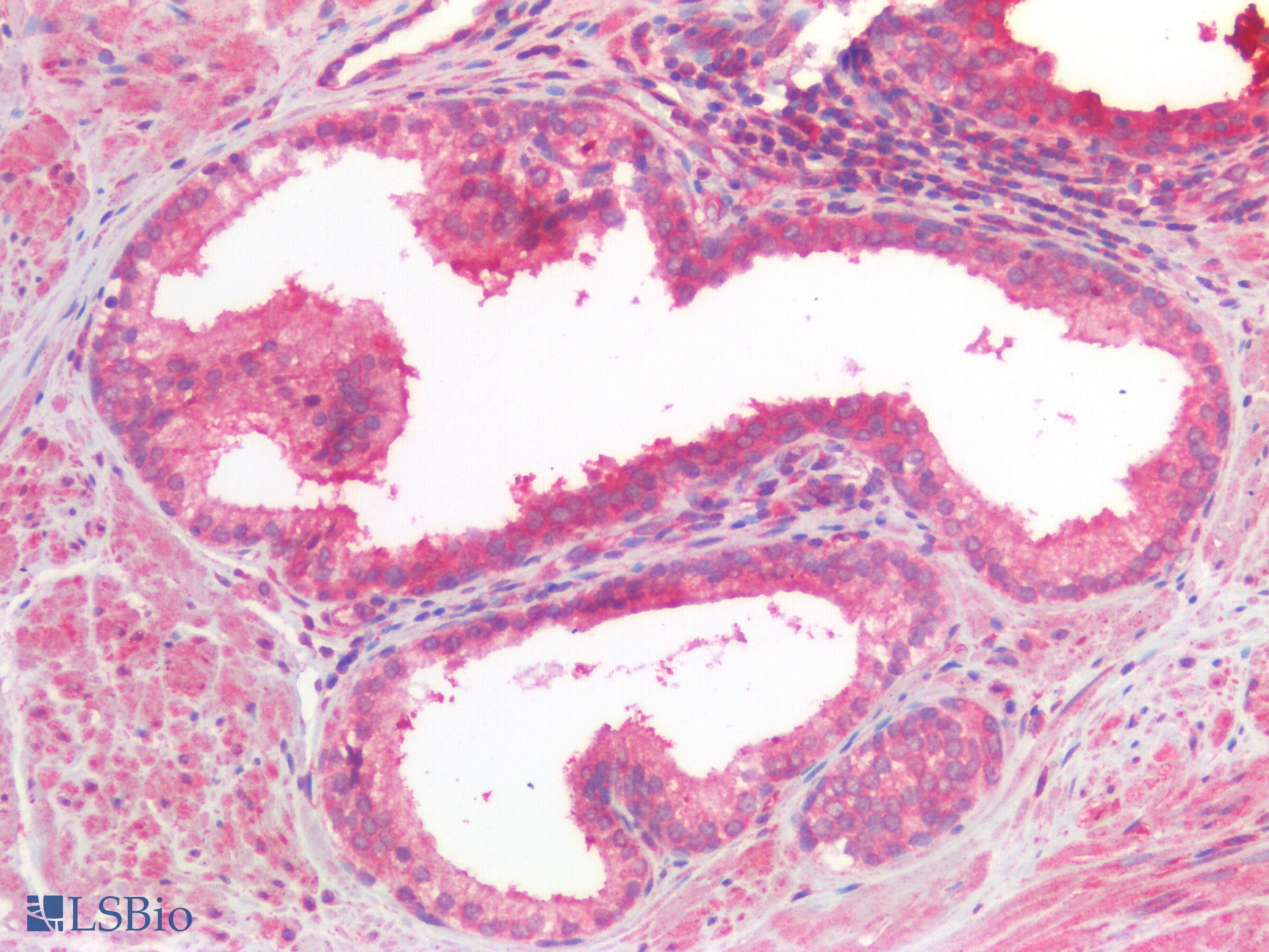 PathPlus™ Polyclonal Rabbit anti-Human CANX / Calnexin Antibody (IHC)