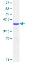 Human TBCA Protein (Recombinant GST)