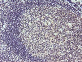 SOLO / SESTD1 Antibody (clone OTI4B10)