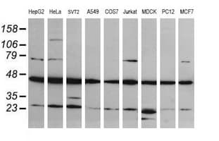MAP2K1 / MKK1 / MEK1 Antibody (clone OTI3H5)