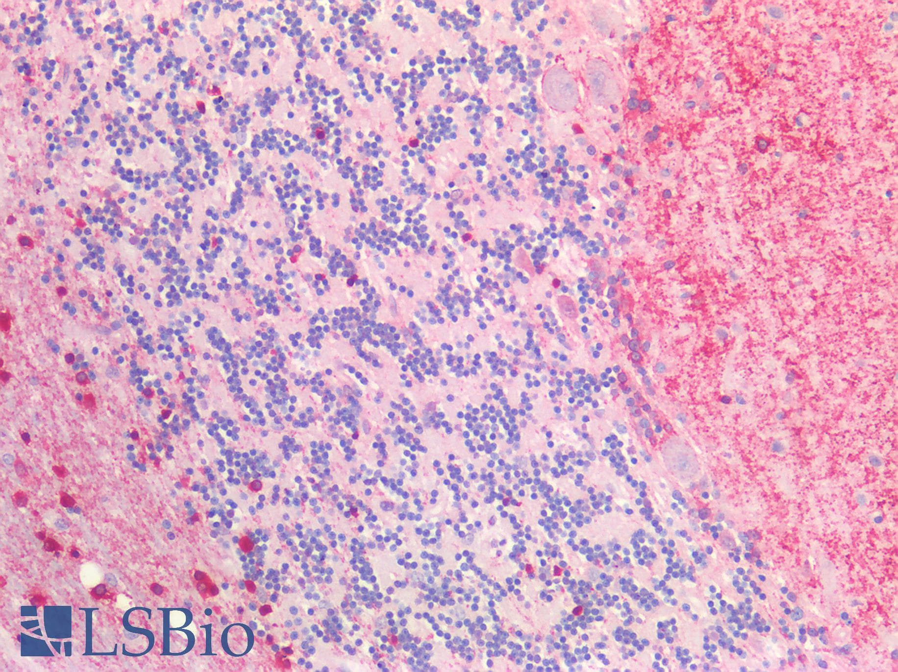 IHC-plus™ Proenkephalin / PENK Antibody