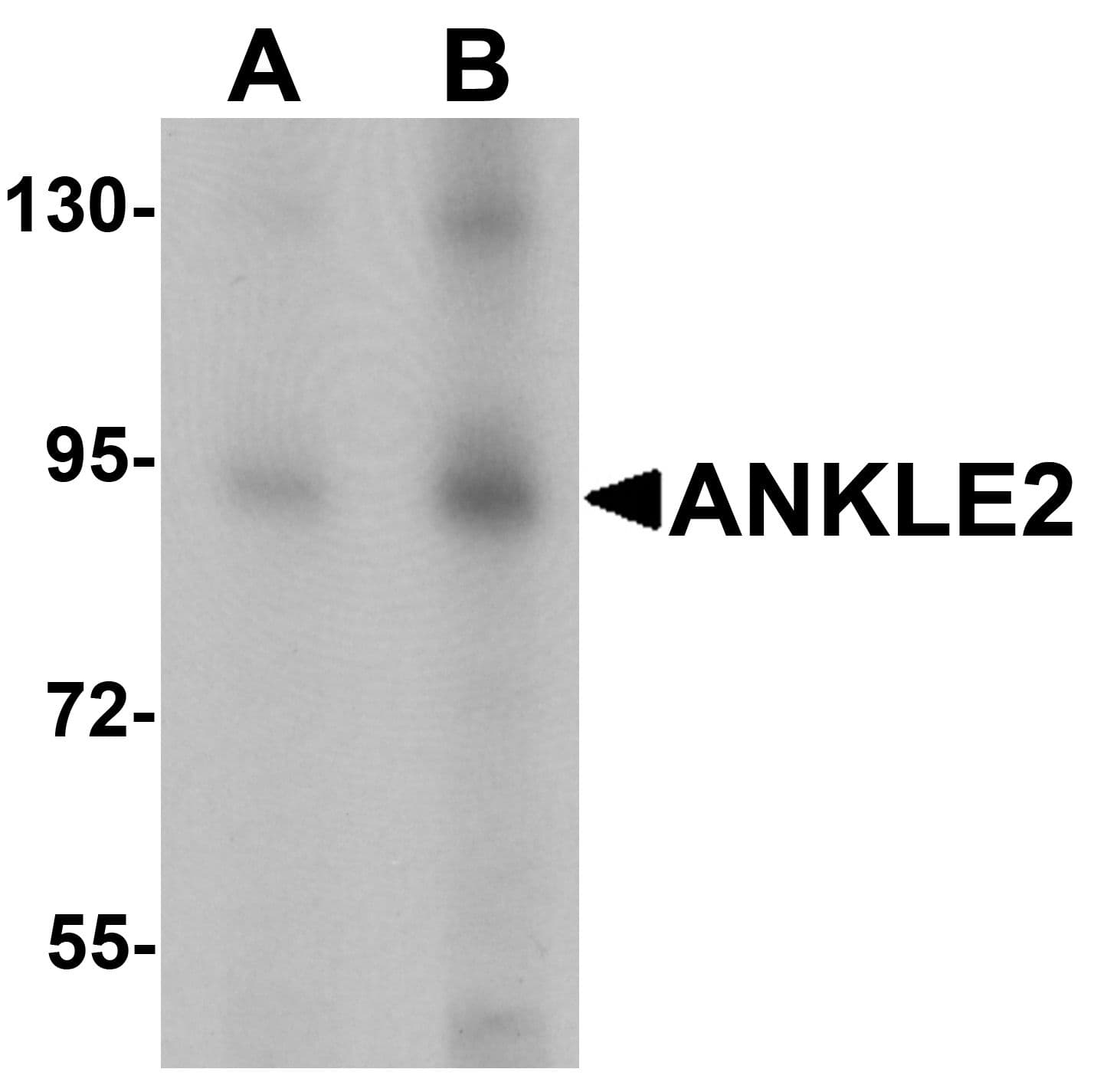 IHC-plus™ KIAA0692 / ANKLE2 Antibody