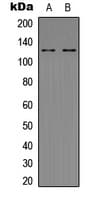 IHC-plus™ Polyclonal Rabbit anti-Human POM121 Antibody (C-Terminus, IHC, WB)
