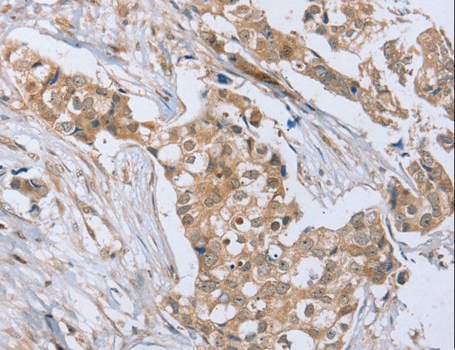 RAB8B Antibody