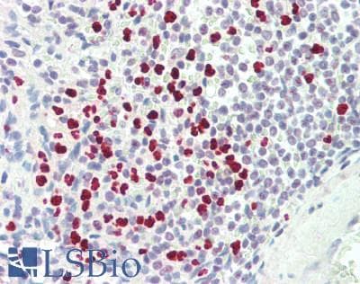 IHC-plus™ PADI4 / PAD4 Antibody (aa2-14)