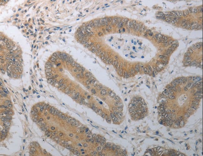 SHH / Sonic Hedgehog Antibody