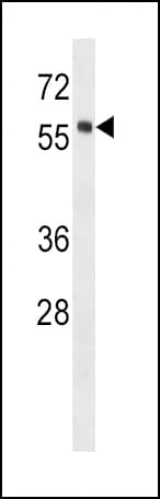HCK Antibody (aa1-30)