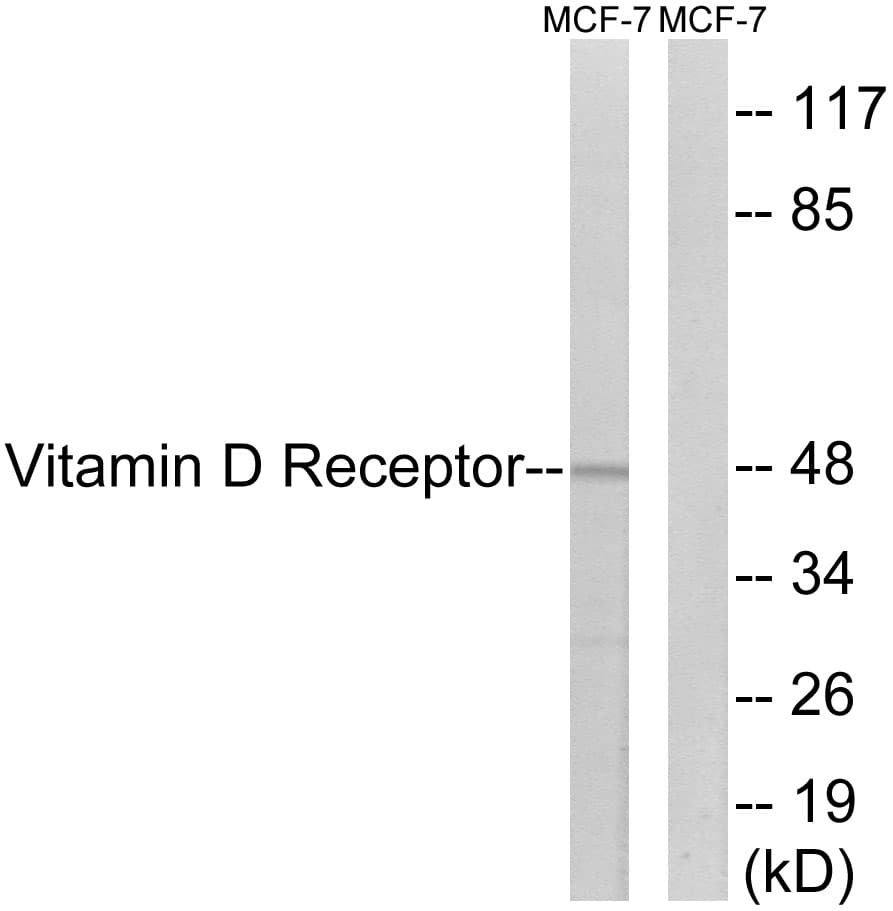 IHC-plus™ Polyclonal Rabbit anti-Human Vitamin D Receptor / VDR Antibody (aa181-230, IHC, IF, WB)