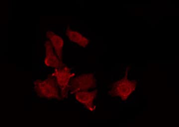 Polyclonal Rabbit anti-Human KCNJ9 / Kir3.3 / GIRK3 Antibody (IF, WB)